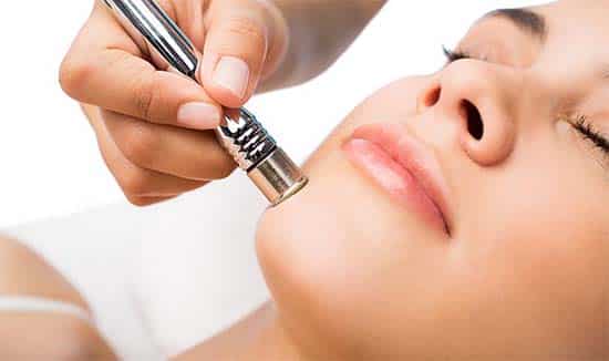 Microdermabrasion Hinckley