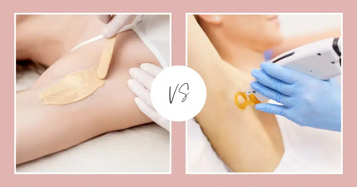 waxing vs IPL