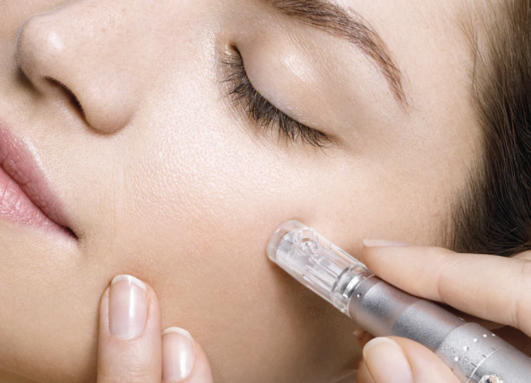 Microneedling