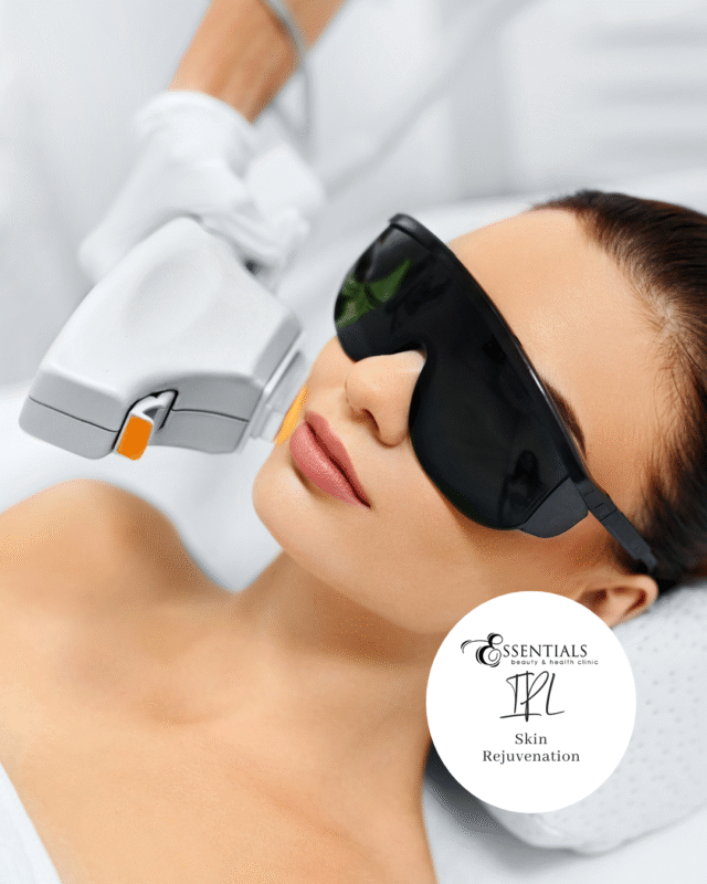 IPL Skin Rejuvenation